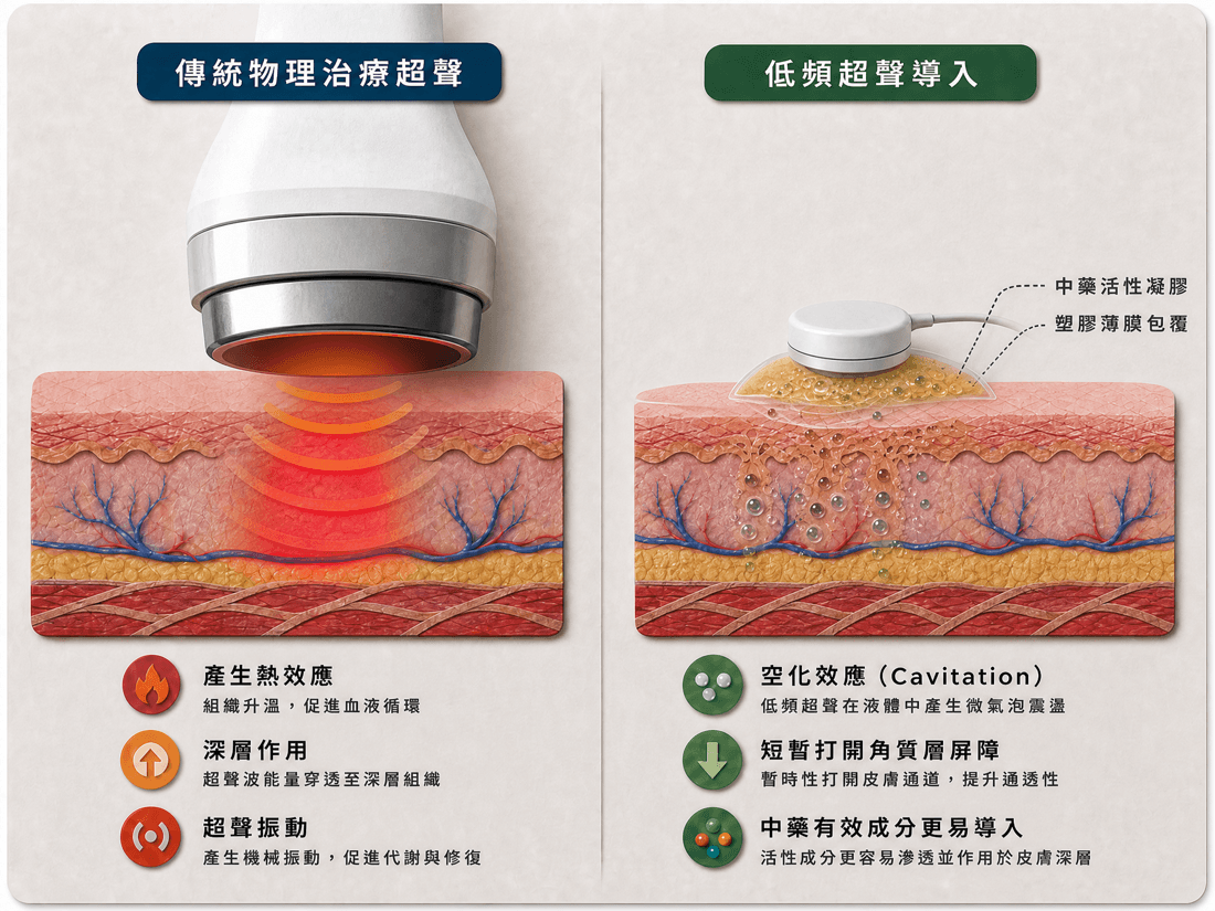低頻超聲導入技術示意圖:空化效應暫時提高皮膚通透性